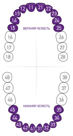 Кламп для коффердама Dentech (Япония) 212 (В6)