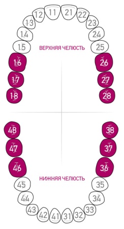 Кламп для коффердама Dentech (Япония) W3