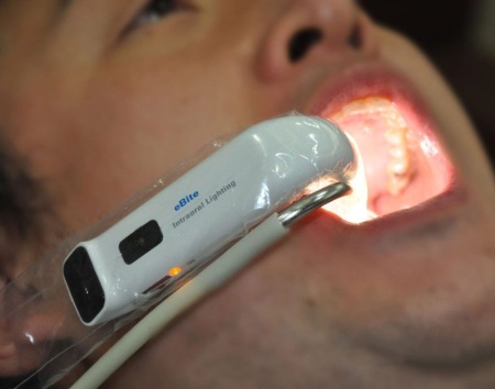 Аппарат для интраоральной подсветки со встроенной системой аспирации "eBite"(полный комплект) Аппарат для интраоральной подсветки со встроенной системой аспирации "eBite"(полный комплект)